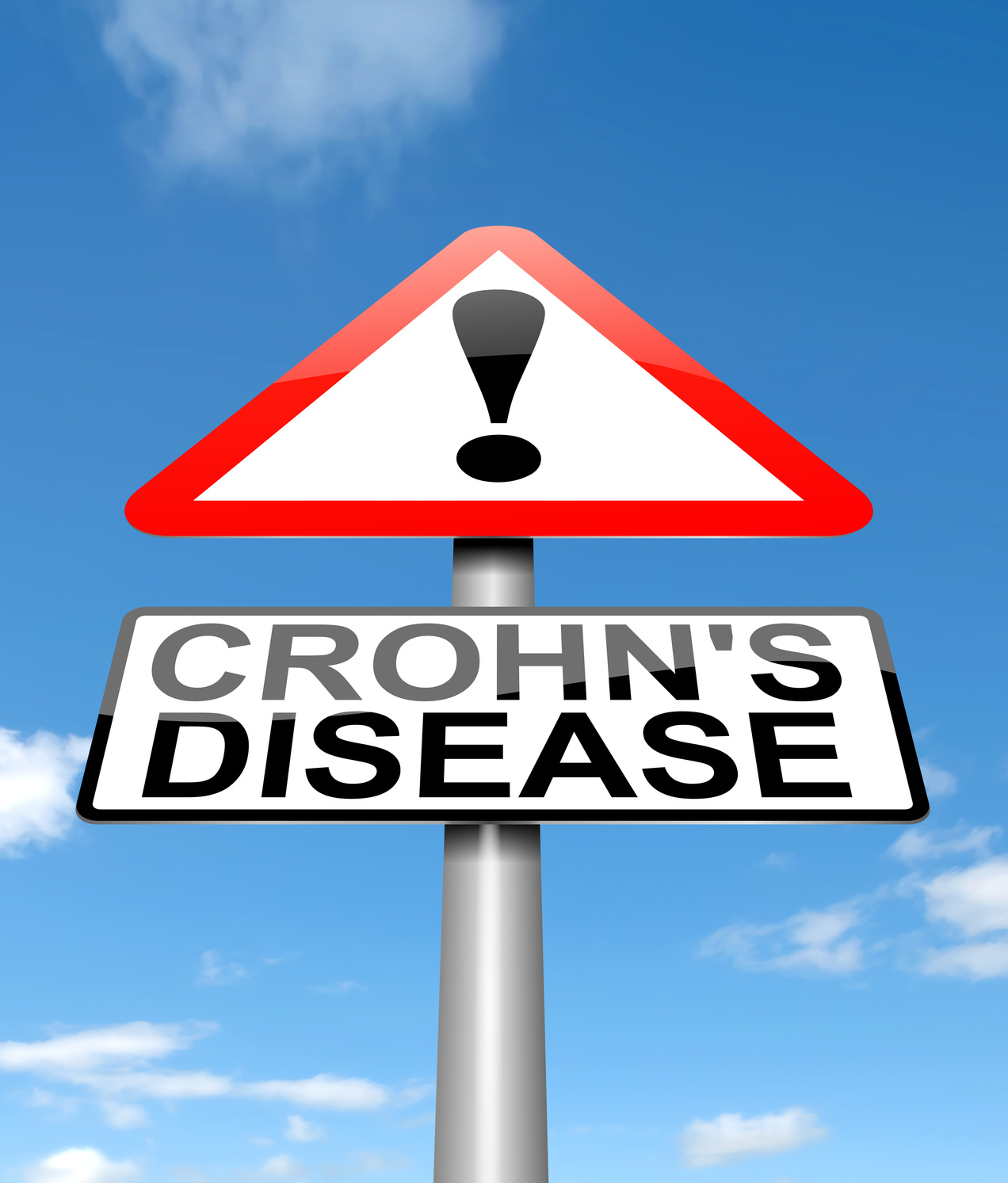 Crohn’s Disease concept.