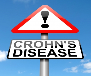 Crohn’s Disease concept. Crohn’s Disease concept.