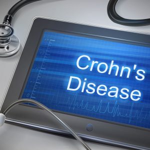 Crohns disease